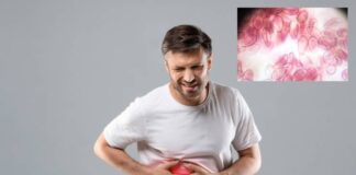 లీవర్ ప్లూక్ అంటే ఏమిటీ.? వీటిని ఎలా ఎదుర్కోవాలి.? - What is liver fluke? How to deal with this? What is liver fluke