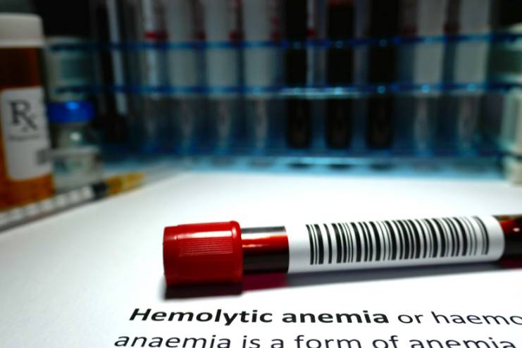 Hemolytic anemia