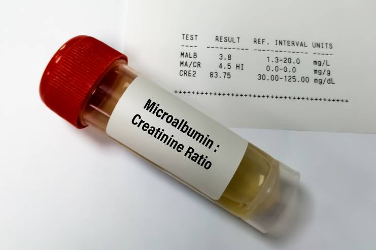 Normal levels of Creatinine