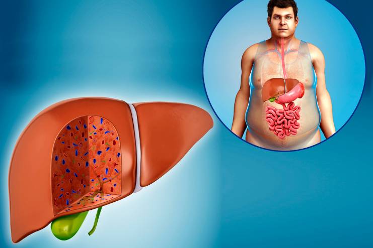 Remedies Liver Anomalies