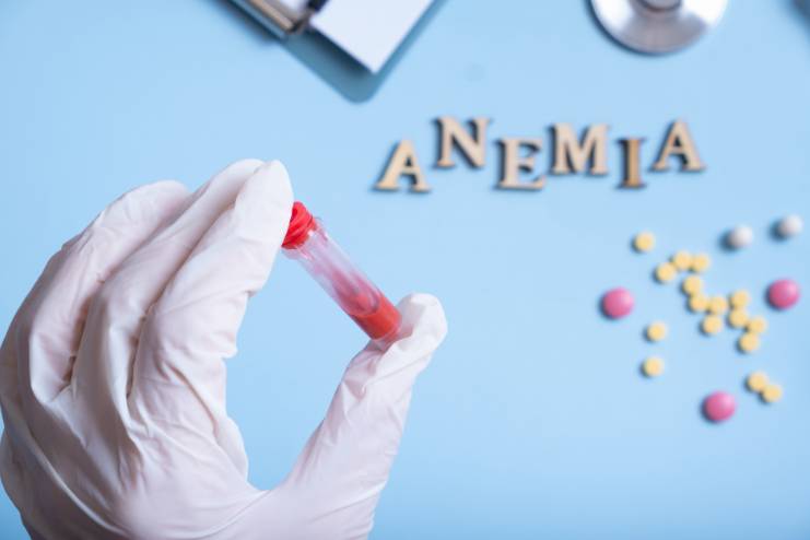 Vitamin deficiency anemia