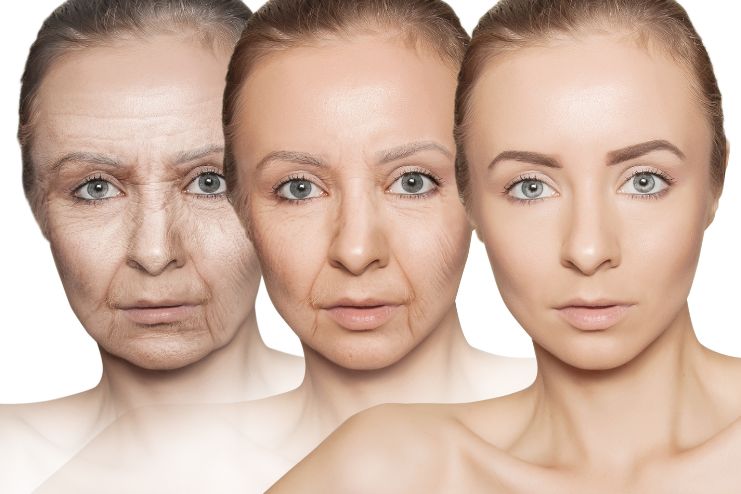 Ageing skin