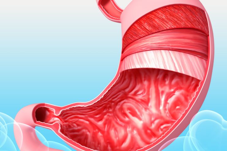 Stomach lining (Mucosa)