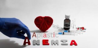 అప్లాస్టిక్ అనీమియా: పెద్దలలో వ్యాధి నిరూపణను ప్రభావిత అంశాలు - Aplastic Anemia: Factors Influencing the Prognosis in Adults aplastic anemia