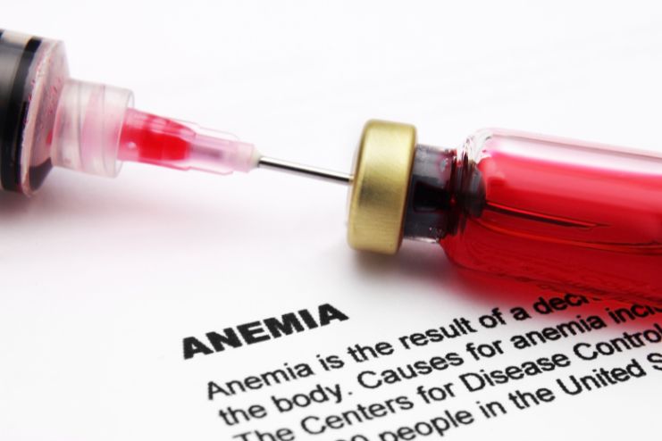 diagnosis of aplastic anemia