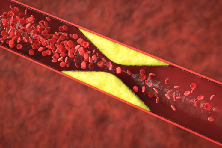 Blood clotting disorders