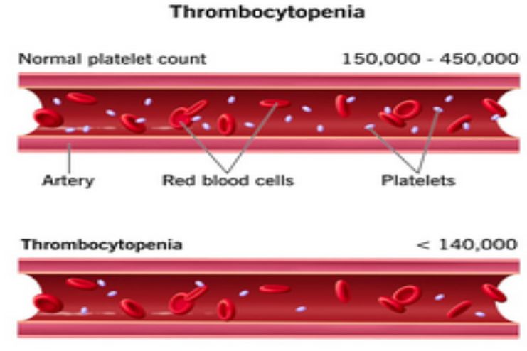 Decreased platelet production