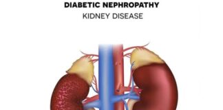 డయాబెటిక్ నెఫ్రోపతీ అంటే ఏమిటీ? కారణాలు, లక్షణాలు, చికిత్స - Diabetic Nephropathy: Causes, Symptoms and Treatment Diabetic Nephropathy