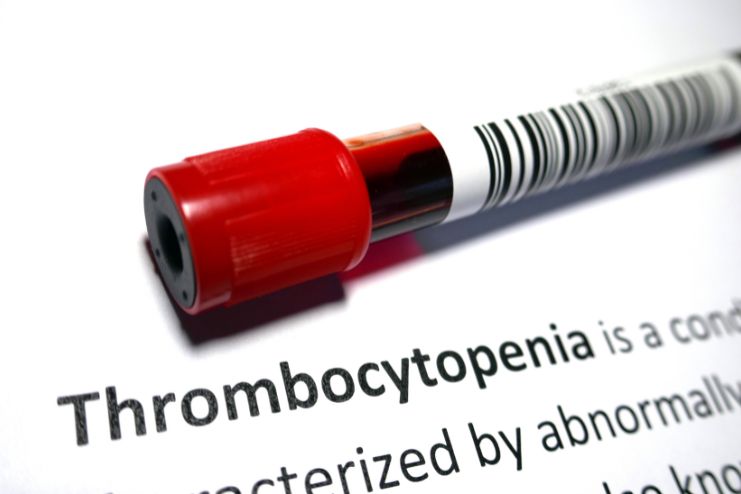 Diagnosis of Thrombocytopenia