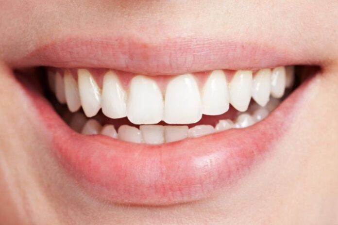 Get Whiter Teeth Fast with These Natural Methods