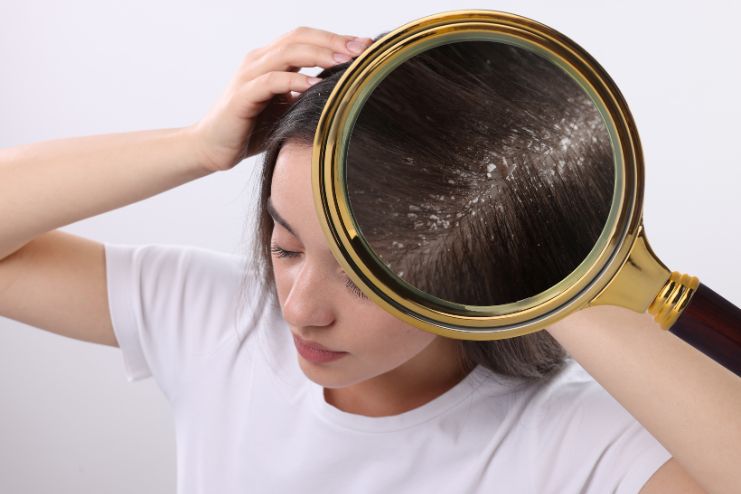 Treatment of Dry skin dandruff