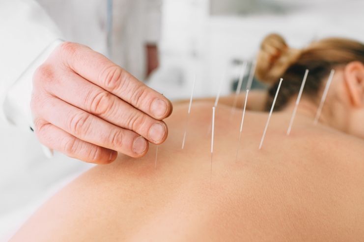 Try acupuncture