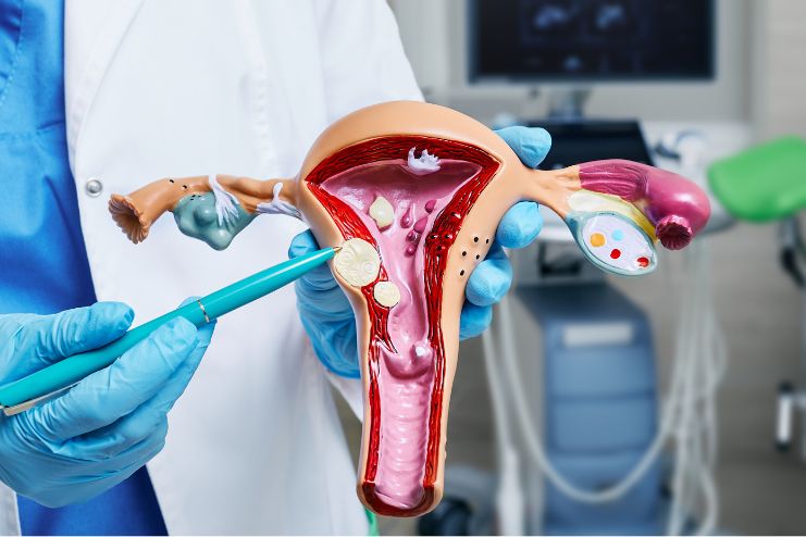 Uterine artery embolization