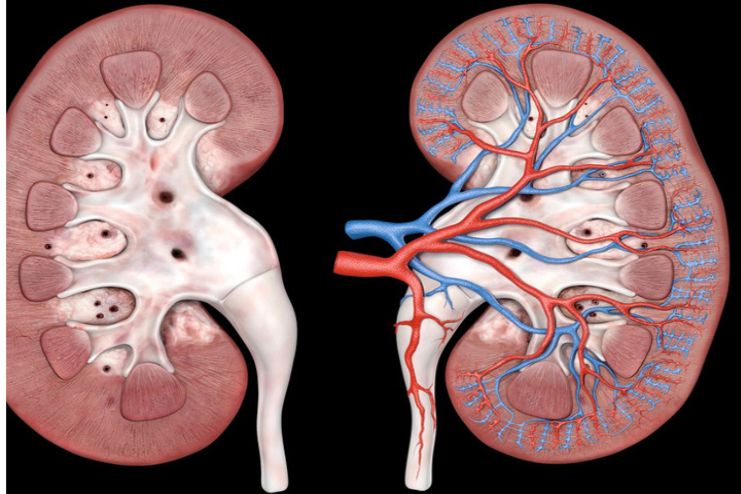 What is diabetic nephropathy