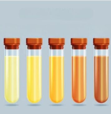 మూత్రం రంగులు: ఏ రంగు ఏమీ చెబుతుందో తెలుసా.! Urine Colors and What Each Shade Say About Your Body