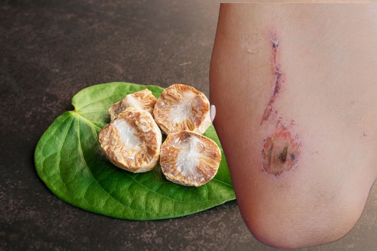 Wound Healing and Skin Health