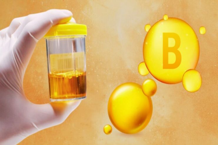 Should continue B complex even if urine is yellow