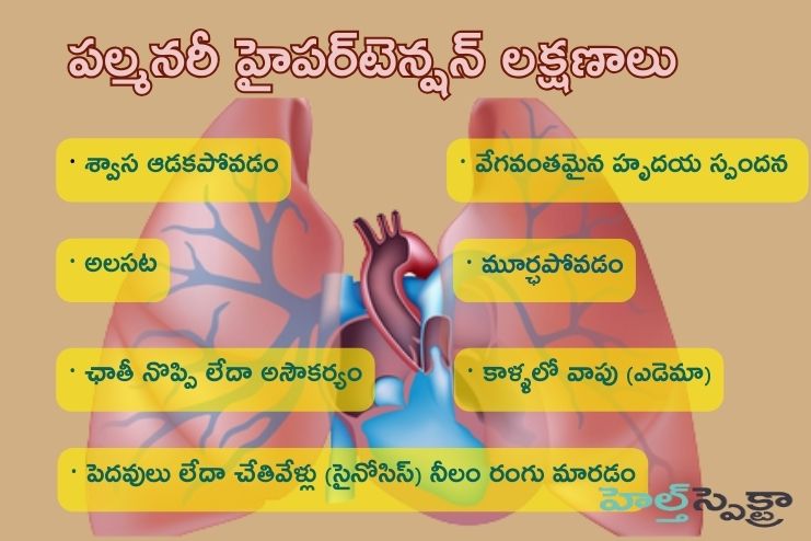 Symptoms of Pulmonary Hypertension
