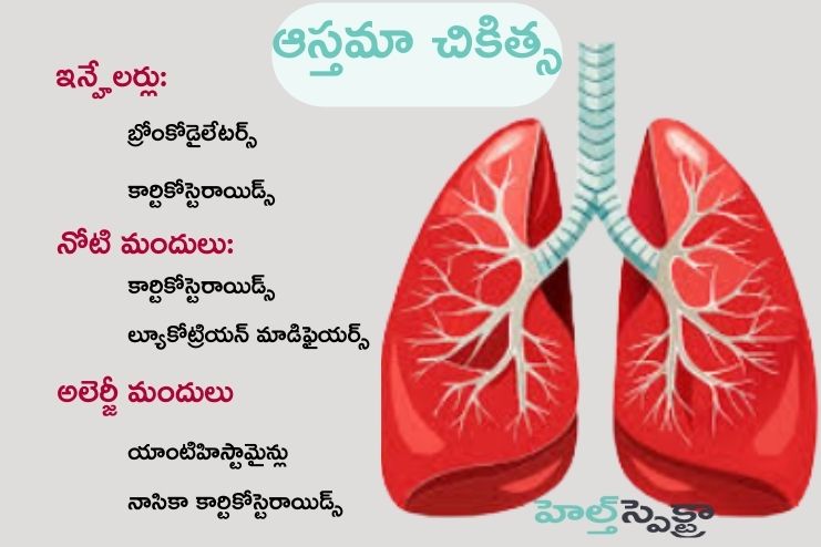 Treatment of Asthma