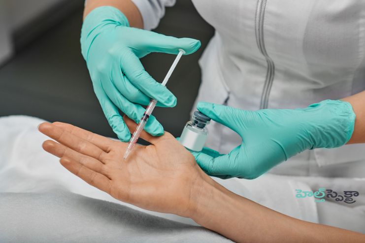 Botulinum toxin injections