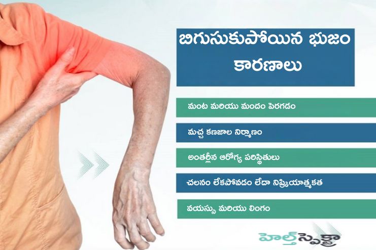 Causes of Frozen shoulder