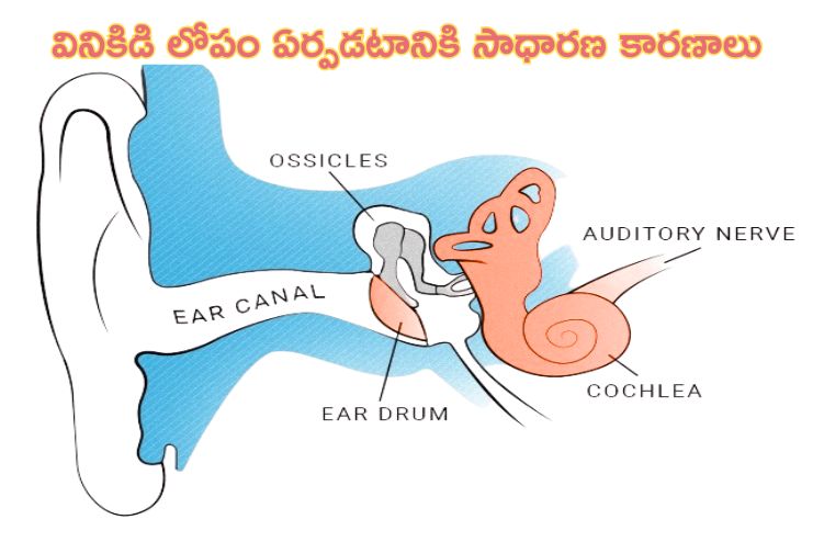 Causes of Hearing Loss