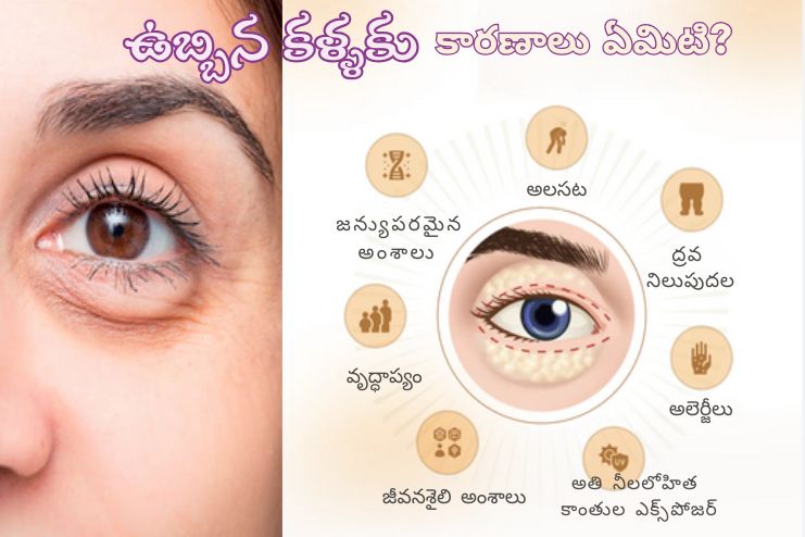 Causes of bags under eyes