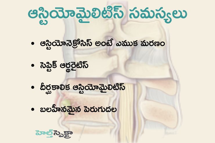 Complications for Osteomyelitis