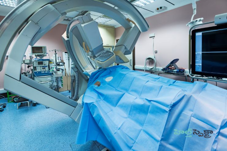 Eye angiography