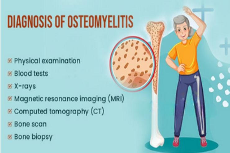 Diagnosis of Osteomyelitis