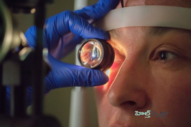 Fundus photography