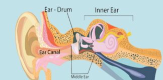 వినికిడి లోపం: లక్షణాలు, కారకాలు, చికిత్స, నివారణ - Hearing loss: Causes, Symptoms, Treatment and Prevention Hearing loss Causes, Symptoms, Treatment and Prevention