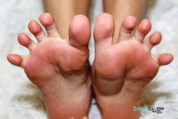 How common is podophobia