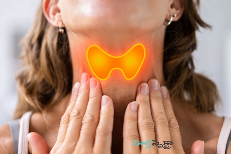 Hyperthyroidism complications