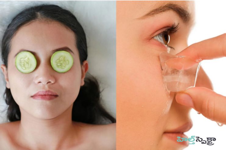 Lifestyle and Home Remedies