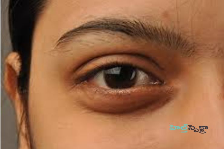 Maintaining eye health