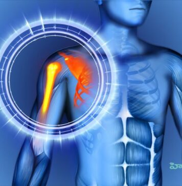 భుజం బిగుసుకుపోయిందా.. అది ఫ్రోజెన్ షోల్డర్ కావచ్చు..! Nerve stimulation