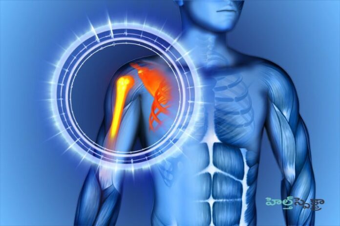 Nerve stimulation