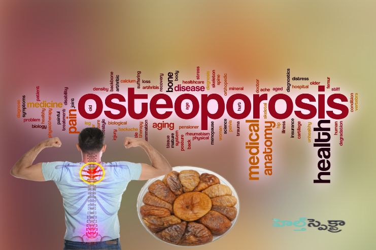 Preventing osteoporosis