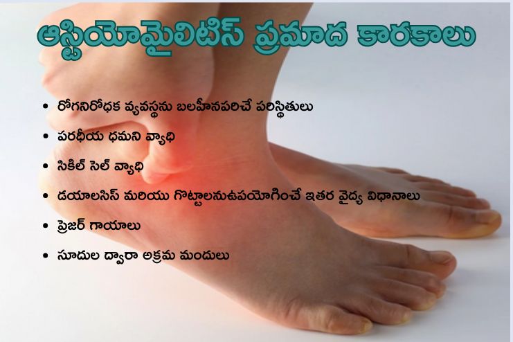 Risk Factors of Osteomyelitis