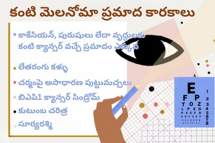 Risk factors for eye melanoma
