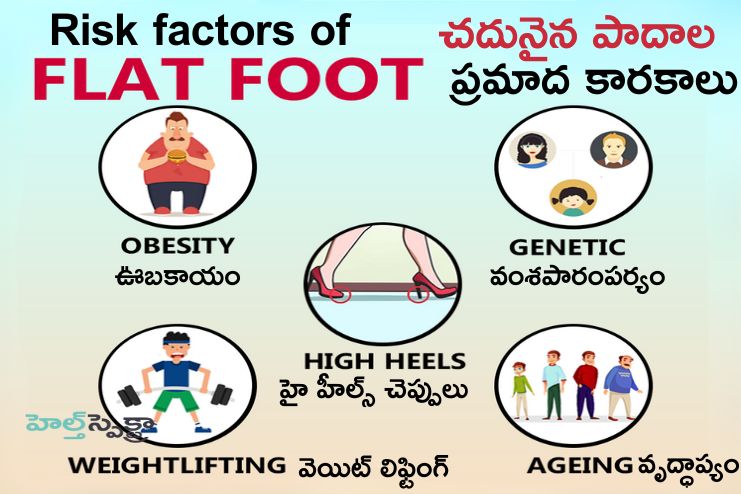Risk factors of Flatfeet