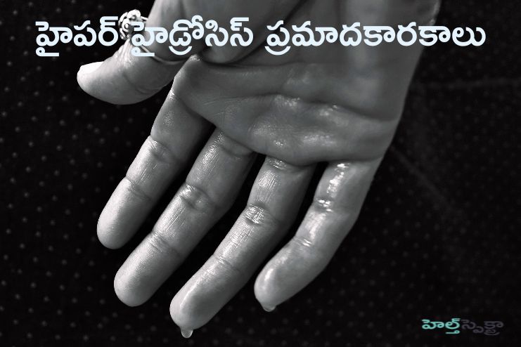 Risk factors of Hyperhidrosis
