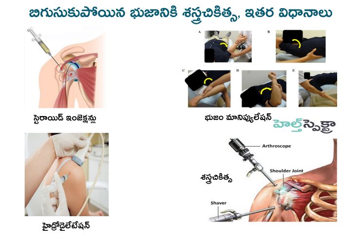 Surgical and other procedures