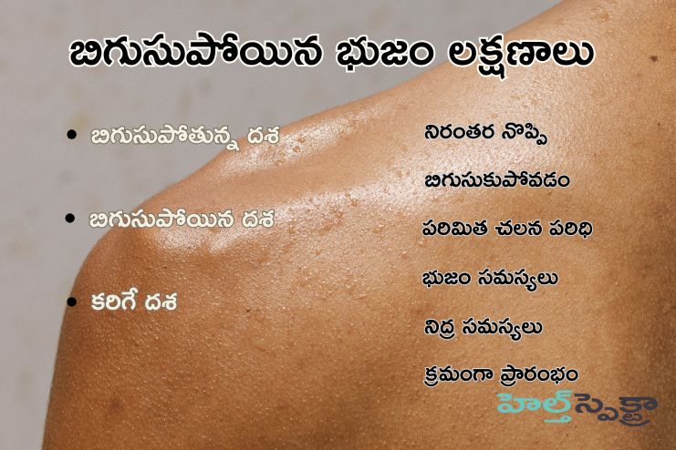 Symptoms of Frozen shoulder