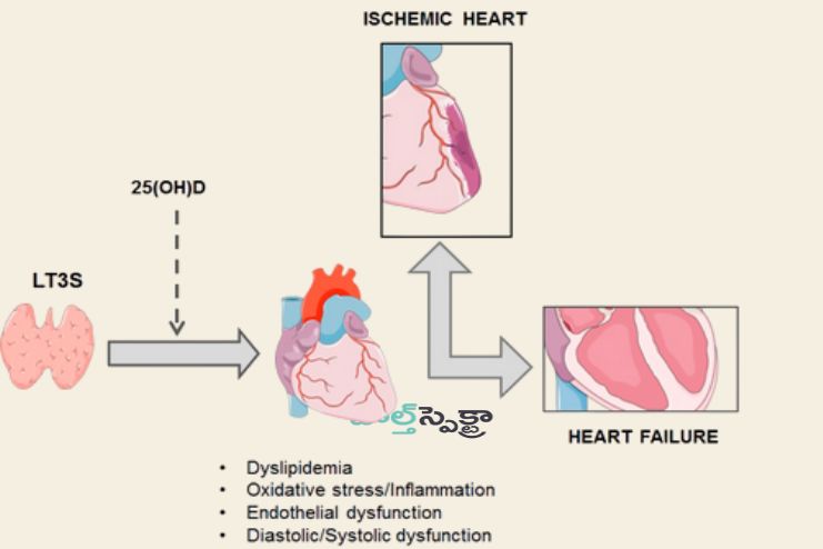 hyperthyroidism and heart failure