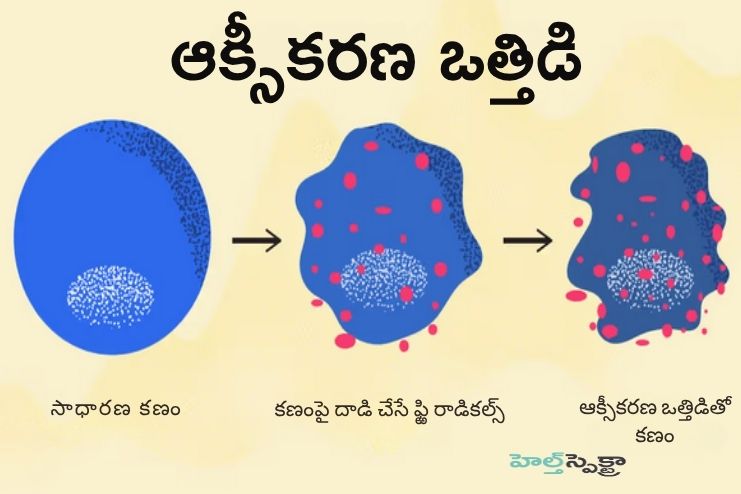 Causes of Free Radicals