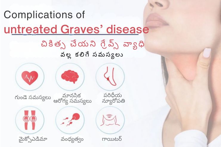 Complications of untreated Graves’ disease