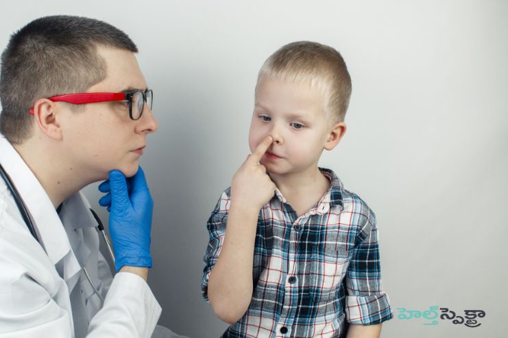 Diagnosis of nasal polyps