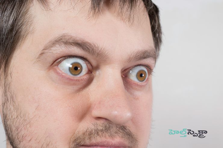 Graves' disease Medications